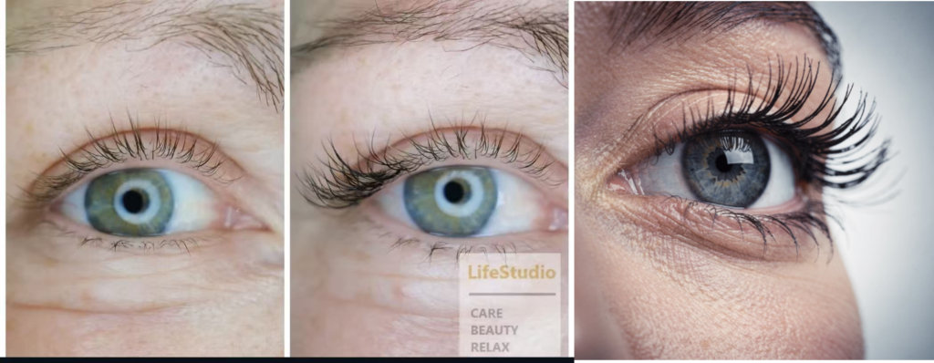 %Beauty Salon Dresden% %Wellness und Beauty in Dresden% %Kosmetische Behandlungen Dresden%